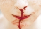 Como parar o Sangue no Nariz